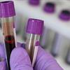 Blood vials